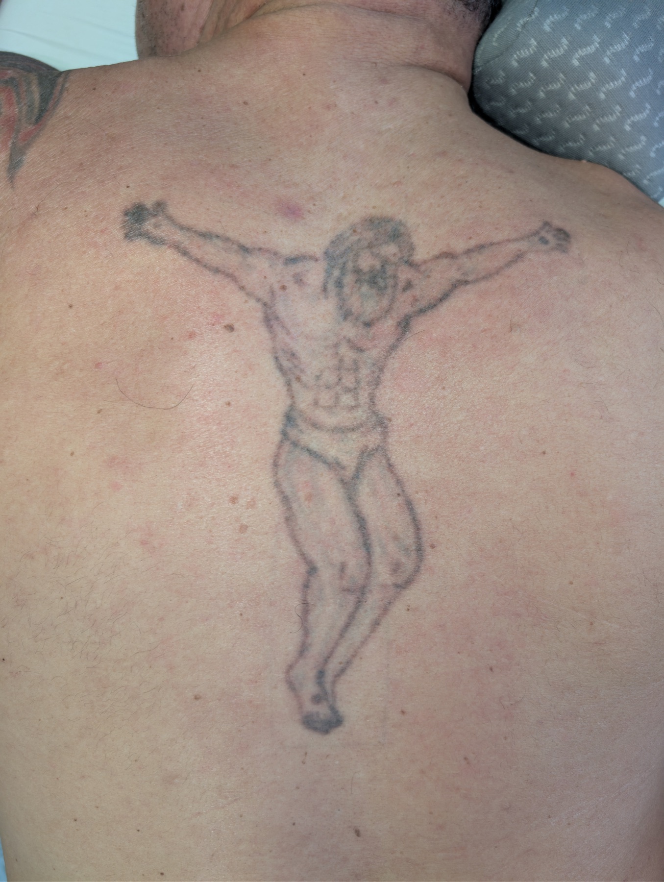 Tattoo nach vier Sitzungen
